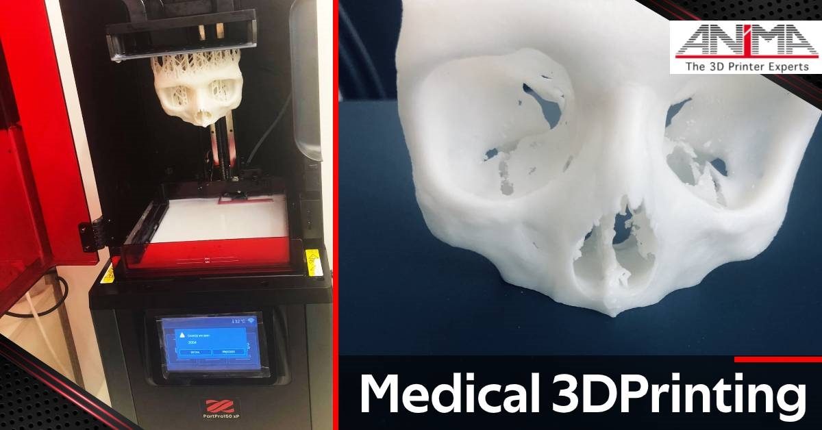 MEDICAL 3D PRINTING